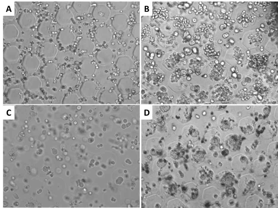 다양한 유방암 세포주가 내재된 알지네이트 세포배양체. (A) 세포배양체에 로딩한 직후의 SKBR3 세포주의 모습. (B) 세포배양체에서 4일 동안 배양한 SKBR3 세포주의 모습. (C) 세포배양체에 로딩한 직후의 HCC70 세포주의 모습. (D) 세포배양체에서 6일 동안 배양한 HCC70 세포주의 모습
