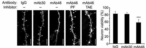 RTK에 의한 spine density감소