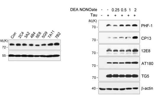 NOS inhibitor(좌)/ donator(우)가 tau 인산화