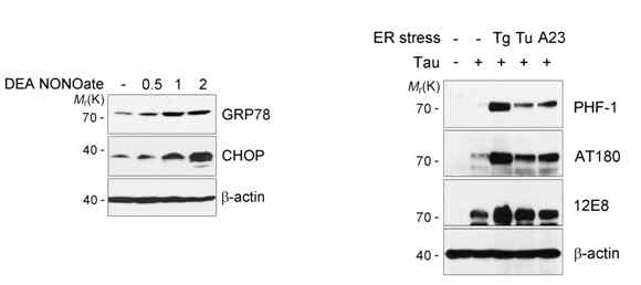 NOS에 의한 ER stress와 tau phosphorylation 변화