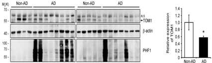AD 환자 해마에서 TOM1 양 감소