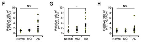 정상인과 MCI, AD brain에서 Lyn 활성화