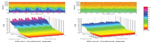 박동성 이명의 수술적 치료 전, 후의 spectro-temporal analysis 비교 분석 결과