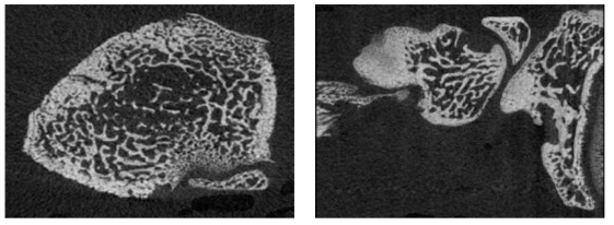 쥐의 대퇴골 해면 구조를 촬영한 micro-CT