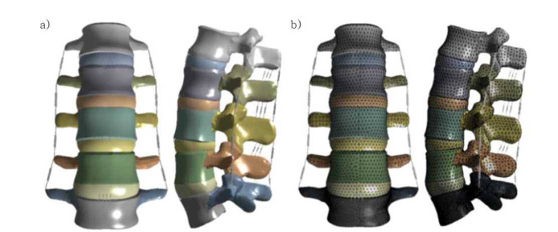 a) 3D 인체 요추 모델 b) 3D 인체 요추 유한요소모델