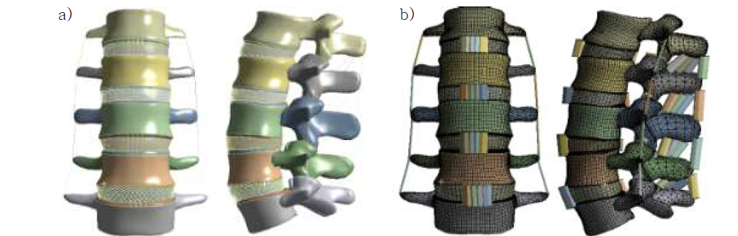 a) 변경된 3D 인체 요추 모델 b) 변경된 3D 인체 요추 유한요소모델