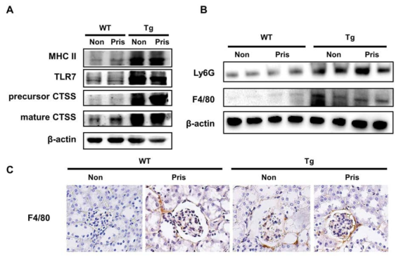 CTSS 과발현 생쥐에서 TLR7의 발현과 신장에 침투한 macrophage, neutrophil 증가