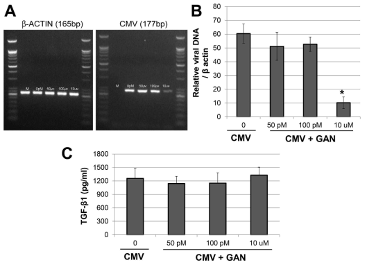 항바이러스 약제인 ganciclovir 를 CMV 에 감염된 인간 섬유주세포에 처치한 후, viral DNA 및 TGF-β1 의 발현을 관찰한 모습
