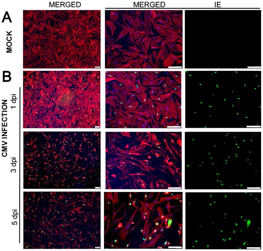 인간 섬유주세포에 CMV 를 감염 시킨 후, 초기에 발현되는 immediate early antigen 이 감염1 병일 째부터 활발하게 발현되는 모습