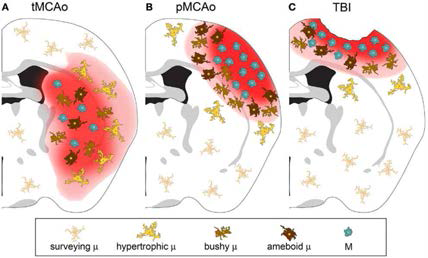 astrocyte and microglia change in ischemic stroke and TBI (Fumagali S et al., 2015)