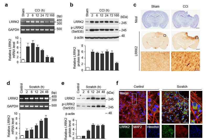 TBI 동물 모델 (CCI) 및 신경세포 모델 (scratch injury)에서의 LRRK2 발현 분석
