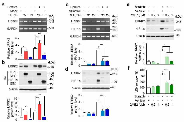 HIF-1α 의존적 LRRK2 발현 조절 분석