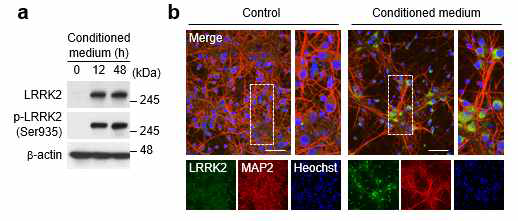 신경손상 후 배양액에 의한 LRRK2 발현 분석