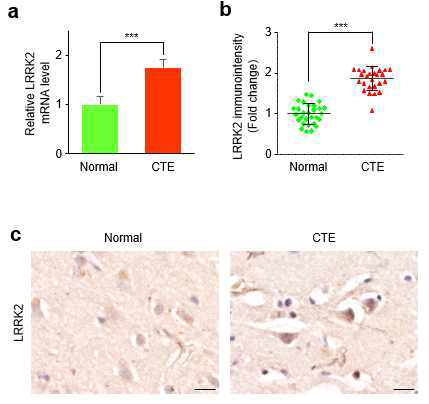 CTE 환자 뇌조직에서의 LRRK2 발현 분석