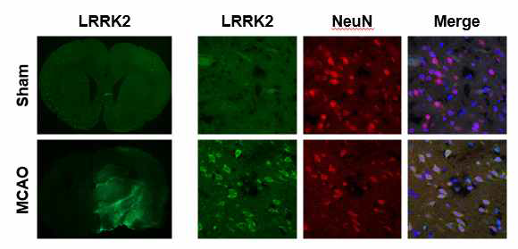 MCAo 동물 모델 손상 부위에서의 LRRK2 발현 분석