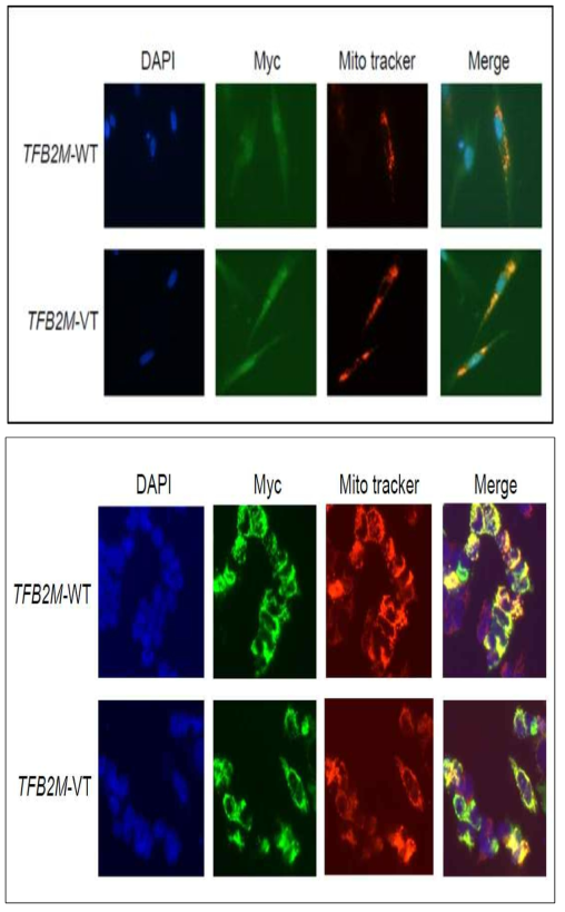 과발현된 TFB2M variant 단백질의 localization (human primary-cultured fibroblasts and SH-SY5Y human neuroblastoma cells)