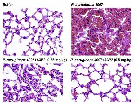 Histology of P. aeruginosa-infected mouse lungs stained with H&E. The lungs were harvested on day 4 after infection