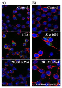 Immunocytochemical activity of KW4 peptide on induced inflammation reaction in the RAW 264.7 cells. The cell was stimulated of TNF-α cytokine when it was treated of S. aureus-LTA and S. aureus 1630 drug resistant strain with or/and without KW4 peptide. The cell cytoplasmic stained using Alexa Fluor 568 phalloidin (rad) and TNF-α antibody (green). The size bar = 10 μm