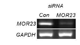 MOR23 knockdown efficiency by siRNA was monitored by semi-quantitative RT-PCR