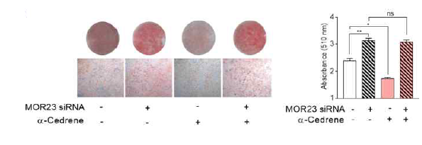 A reduction in MOR23 expression by specific siRNA increases intracellular lipid accumulation in 3T3-L1 cells. Oil red O staining of 3T3-L1 cells transfected with MOR23 siRNA with or without 100 μM α-cedrene