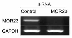 MOR23 knockdown efficiency by siRNA was monitored by semi-quantitative RT-PCR