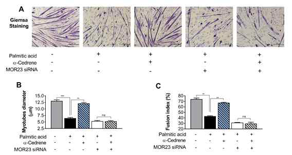 A reduction in MOR23 expression by specific siRNA increases free fatty acid-induced atrophy in C2C12 myotubes. A) After 3 days of differentiation, C2C12 myotubes were treated with vehicle or α-cedrene (100 μM) for 24 h in palmitic acid (0.5 mM) supplemented media. Cells were then fixed with 4% paraformaldehyde and stained by Giemsa. B) Quantification of myotube size. Independent cell culture was carried out in triplicate. At least 300 myotubes were analyzed for both treated and untreated cells. C) Fusion index of myotubes. Significant differences between groups are indicated by asterisks;**p  0.05)
