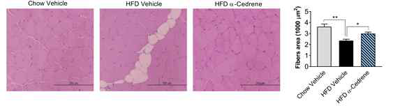 α-Cedrene attenuates skeletal muscle atrophy induced by high-fat diet in mice. A) Representative H *p < 0.05; **p < 0.01