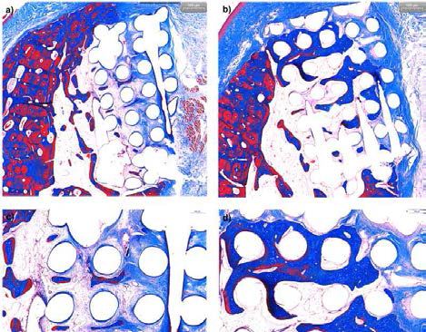 조직 사진 (좌: rhBMP-2/PCL, 우: rhBMP-2/PCL/beta-TCP)