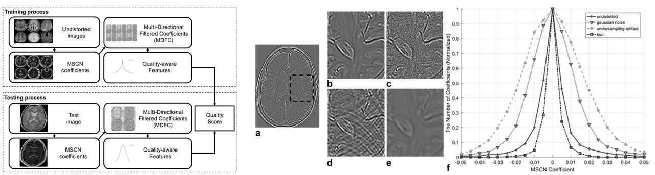 본 연구진이 개발한 다방향 필터 및 영상 통계 기반 비 참조 자기공명영상 평가 기술