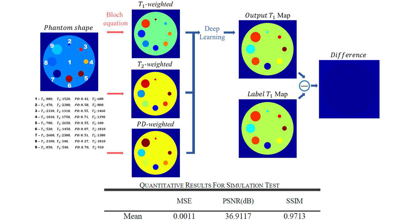 시뮬레이션 데이터에 대한 딥러닝 기반 T1 map 생성 기술 결과와 정량적 수치