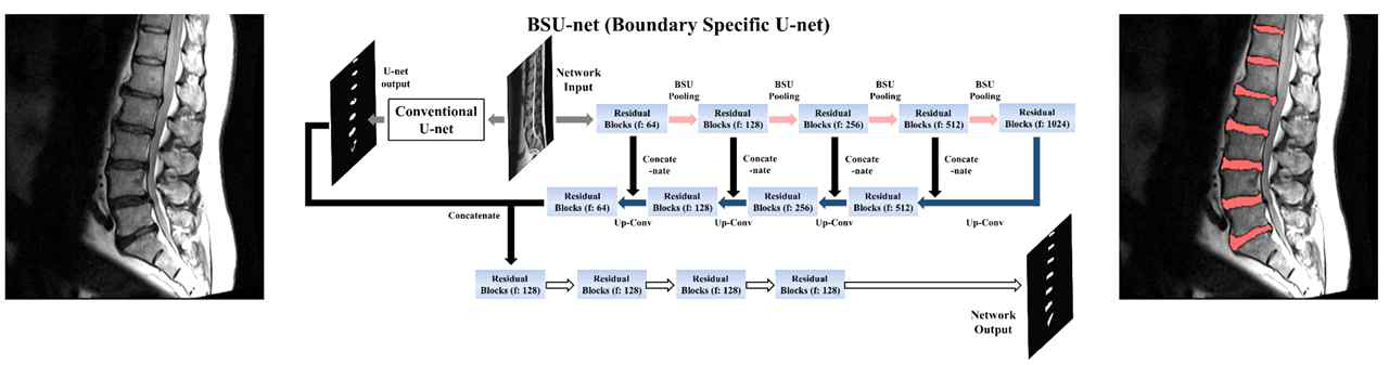 본 연구진이 개발한 척추 세분화 인공지능 네트워크의 구조도 및 결과 영상