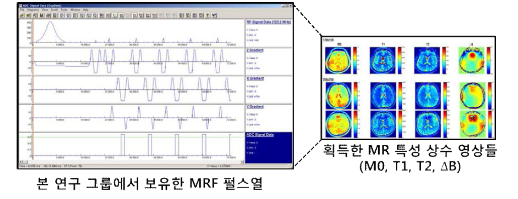 본 연구 그룹이 구현한 대용량 자기공명 데이터의 고속 펄스열 기술