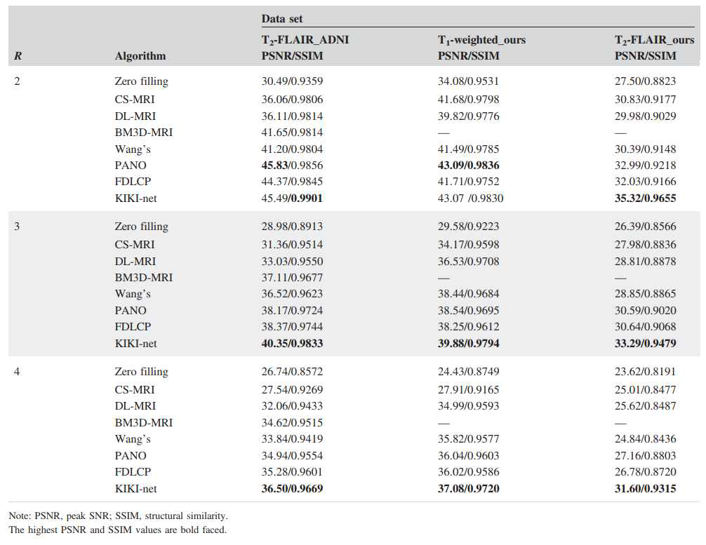 본 연구진이 개발한 교차 도메인 합성곱 신경만 기반 과소 샘플링된 자기공명 데이터 재구성 기술(KIKI-net)과 기존 방식과의 정량적 수치 비교 결과