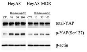 YAP expression after dobutamine treatment