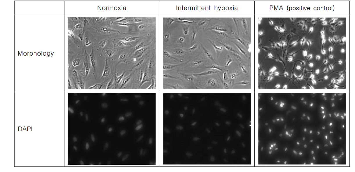 Intermittent hypoxia의 morphology 와 nucleus 에 미치는 영향