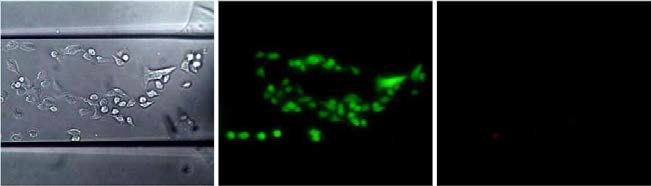 미세유체 소자 내에서 배양된 세포의 BF 이미지(좌) 및 Live/Dead cell assay 형광이미지(가운데, 우)