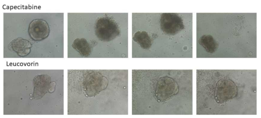 TP53(+) 환자 대장암 조직에서 오르가노이드 제조 및 항암제 효과 분석