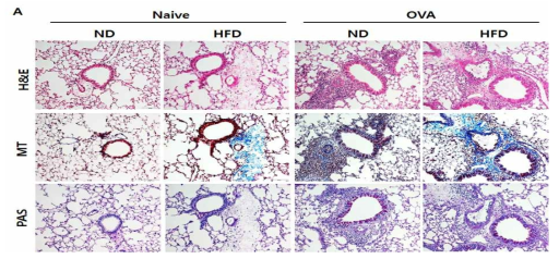 비만유발 천식 마우스에서의 조직병리학적 특징
