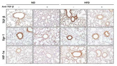 TGF-β 억제제 처리에 따른 마우스 폐 조직에서의 TGF-β, Egr-1, HIF-1α 발현 정도의 변화