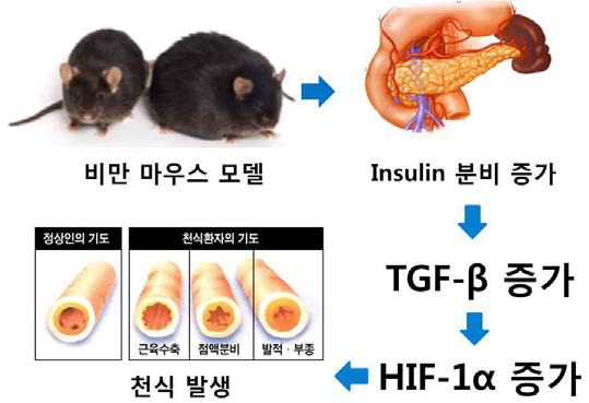 결과로 미루어본 비만 천식 기전