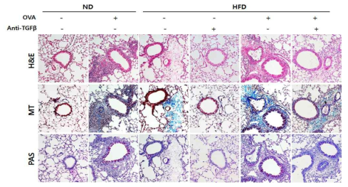 비만유발 천식 마우스 모델에 TGF-β 처리에 따른 폐의 조직병리학적 변화