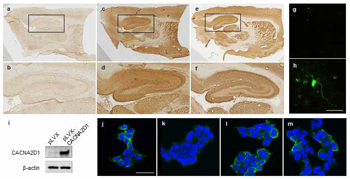 환자의 샘플이 rat brain section염색에 반응하며 (a~f), primary neuron염색에 양성반응임 (h). CACNA2D1 overexpression cell line을 제작했고(i), 세포염색에서 환자 샘플이 세포에 염색됨을 confirm함 (l,m)