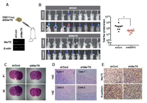 Orthotopic mouse model을 이용한 MERTK의 임상유효성 평가