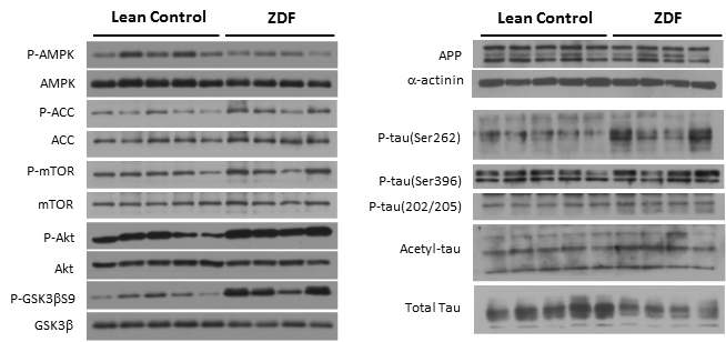 28주령 ZDF 대뇌피질에서 에너지대사 및 AD 병리기전 관련 단백질의 발현 변화