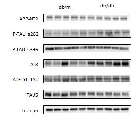 30주령 db/db 대뇌 피질에서 AD병리기전 관련 단백질의 발현 변화