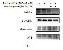 Rab1A가 Ab1-42-induced p-tau의 발현에 미치는 영향