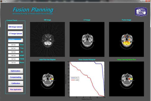 양성자붕소융합치료(PBFT)를 위한 방사선치료계획시스템 프로토타입에 대한 GUI 구상도. 신진연구 수행 기간 동안 최적화 기본 엔진이 포함된 GUI는 개발이 완료되었음