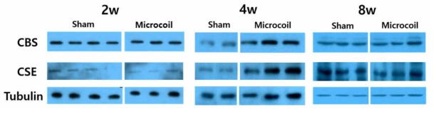 저혈류 모델(MCH model)에서 CSE와 CBS에 대한 westen blotting
