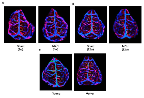 저혈류 모델 쥐 와 노화 뇌의 연막혈관의 영상 비교