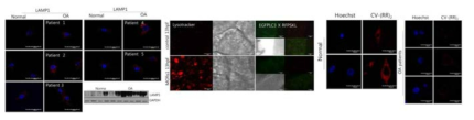 퇴행성관절염 연골세포에서의 lysosome 기능 저하